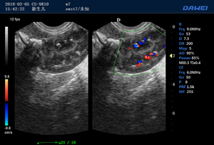 S80高端便携兽用彩超-彩色多普勒多普勒超声诊断仪