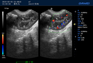 S90高端推车多普勒兽用彩超-动物宠物B超仪扫描图