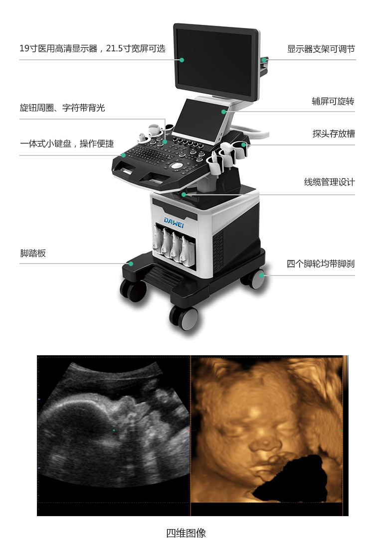四维彩超配置临床图形