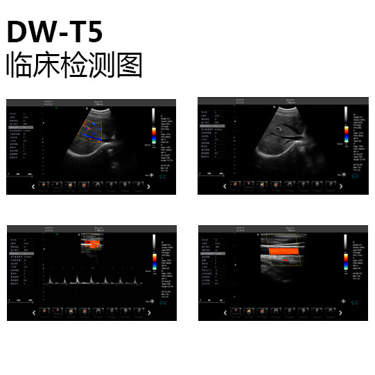 彩超机临床检测图