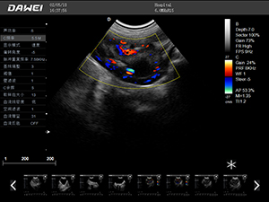 S9兽用彩超机检查图