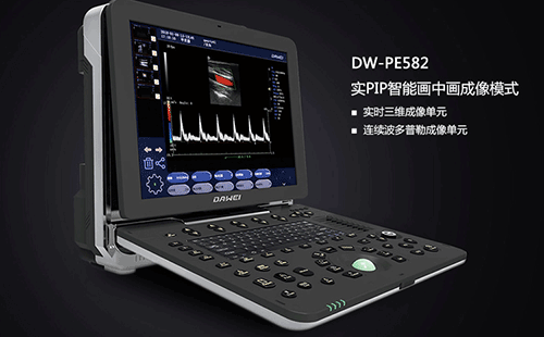 DW-PE582便携式彩超机