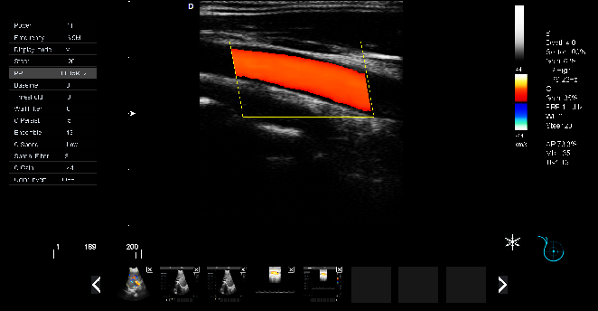 P5-VET便携兽用彩超机颈动脉检查图